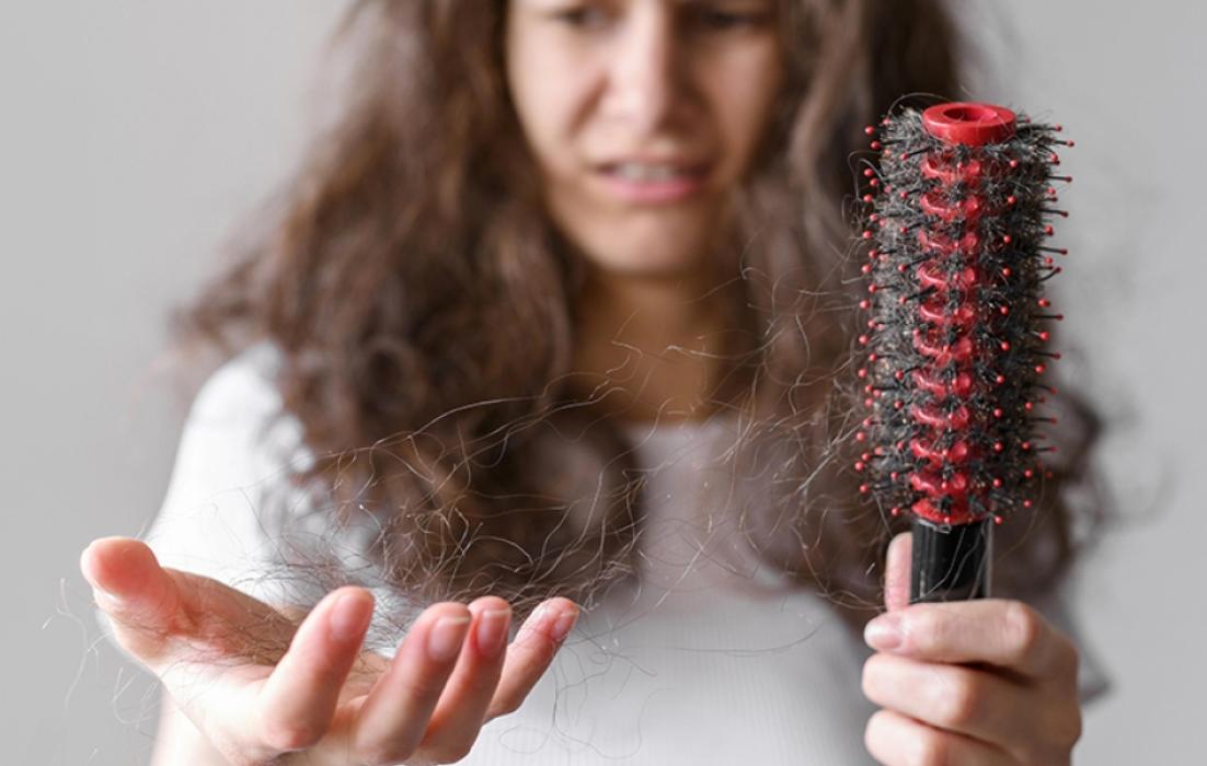 Hair Loss