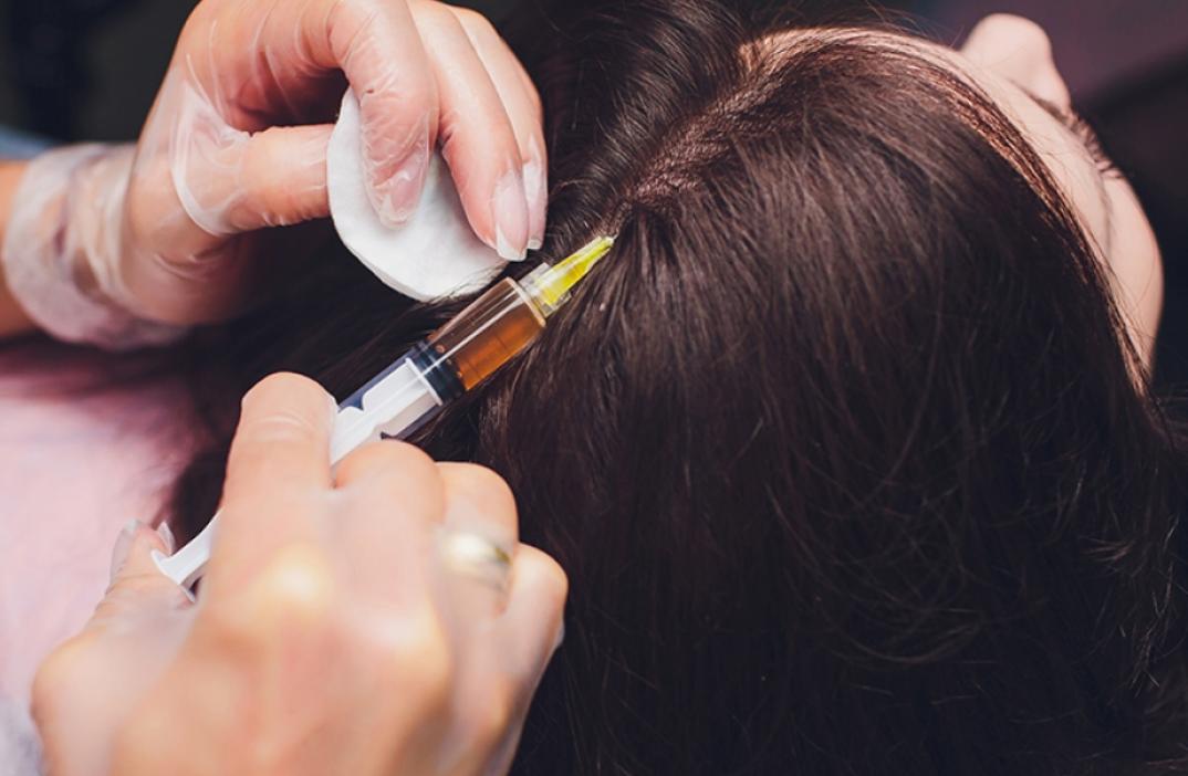 Hair Restoration
