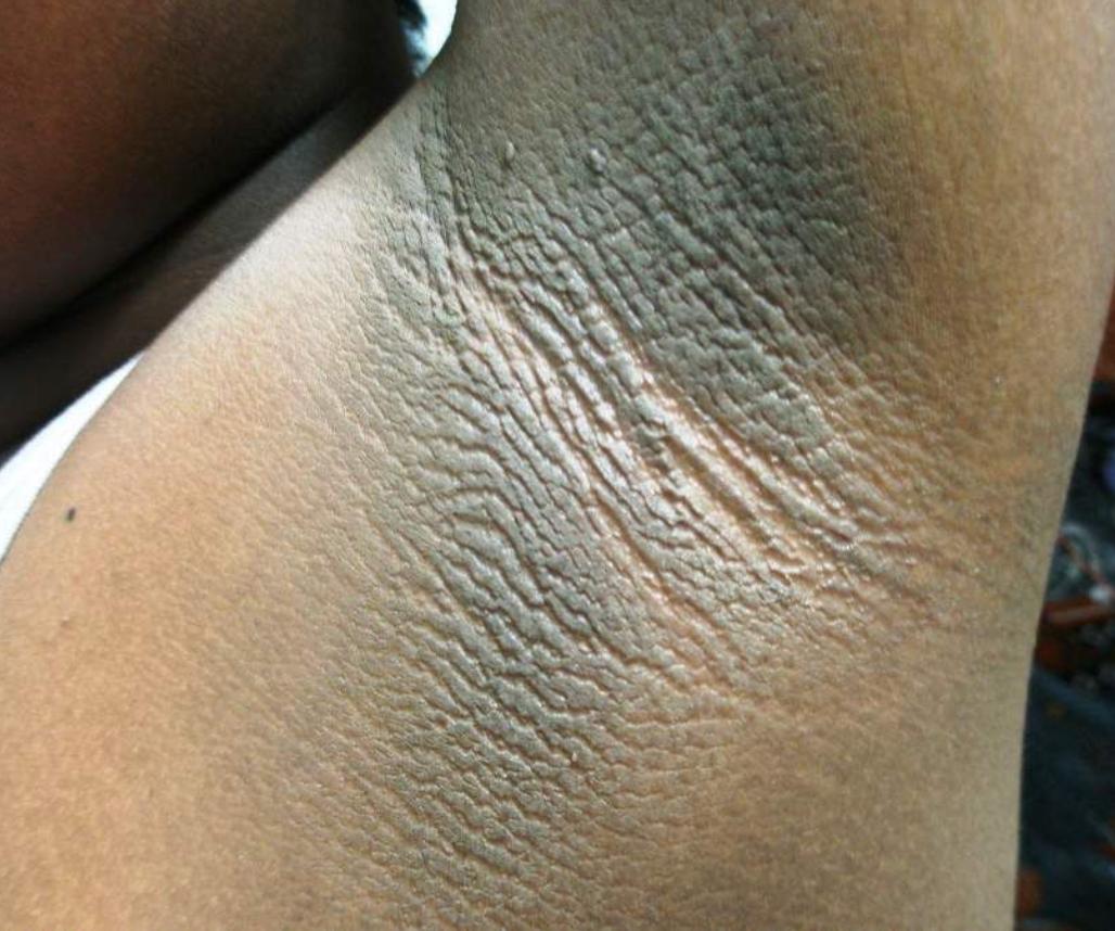 Advanced skin of color dermatology