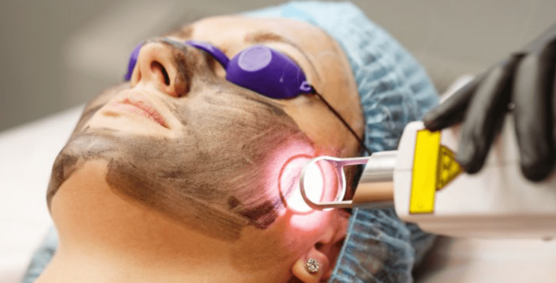 Laser Therapy