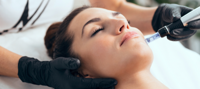 Microneedling