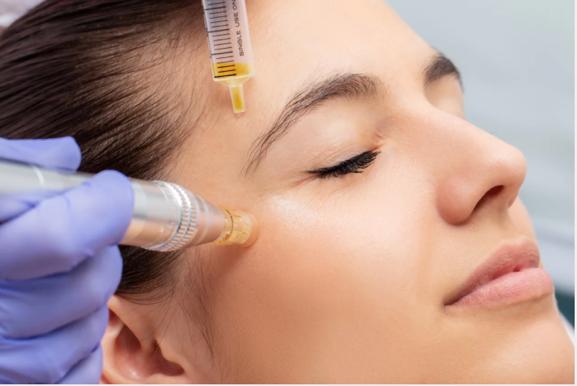PRP/Vampire Facial