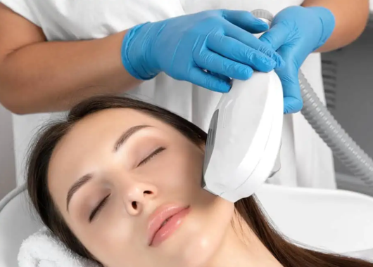 Photofacial (IPL)