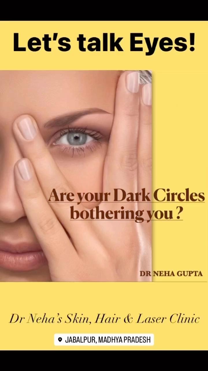 Let's Talk Eyes! Dark Circles Solutions