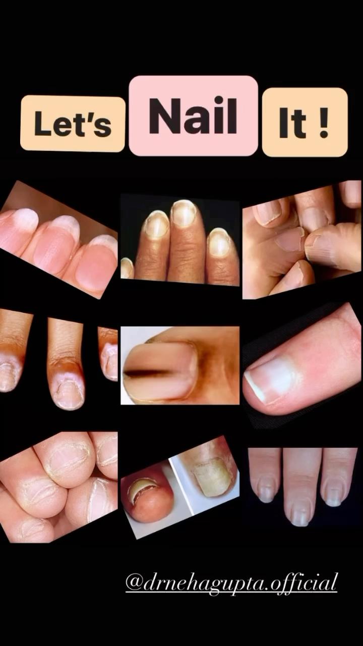 Let's Nail It! Nail Care Guide